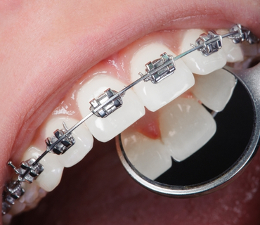 odontologos neiva